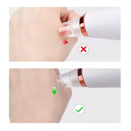 Miteszereltávolító készülék - 6 fej - USB